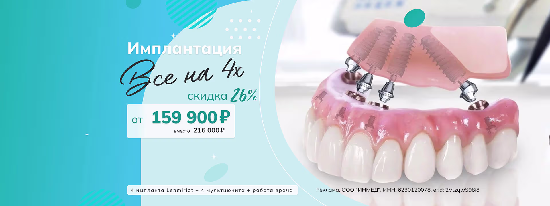Имплантация Все на 4 от 159 900 руб.